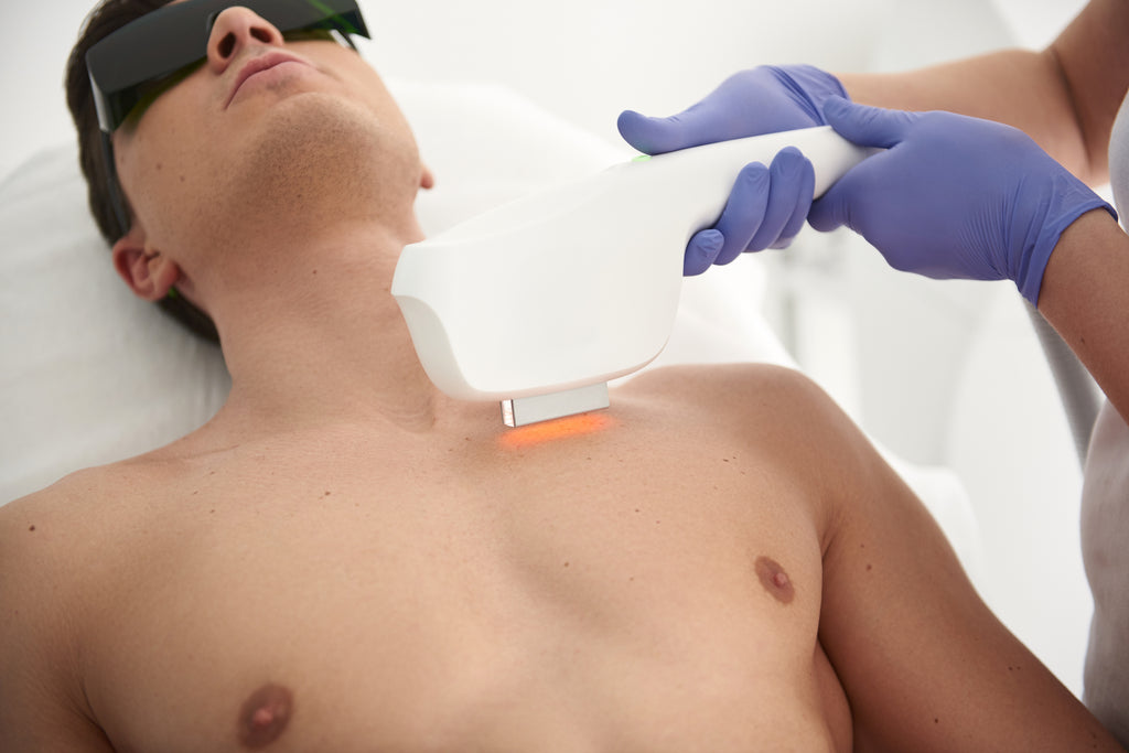 Laser Hair Removal for Men